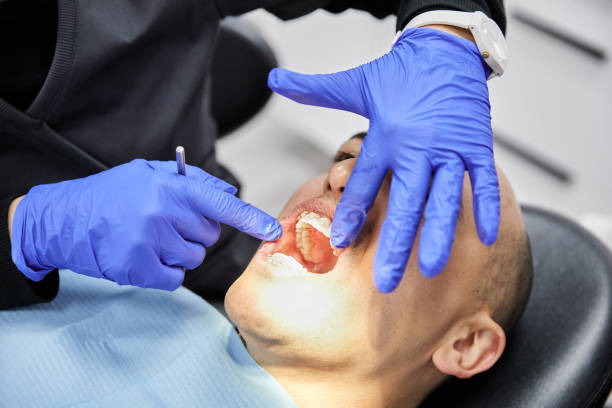 Best Emergency Root Canal Treatment in Smithfield, UT