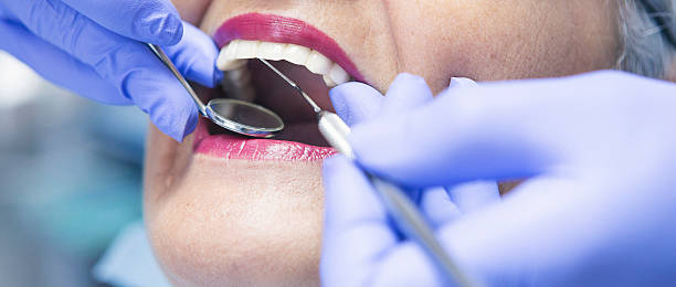 Best Broken or Cracked Tooth Emergency Dentist in Smithfield, UT